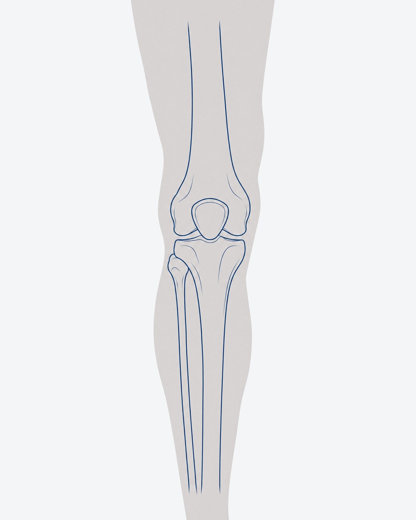 Illustration of a knee with five pain zones marked